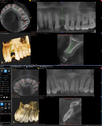 carestream 3d CT