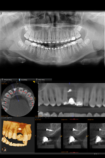 carestream 3d CT